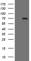EPHX1 ELISA with 2C1 Capture (TA600435) and 4G4 Detection (TA700435) Antibodies. Substrate used: Recombinant Human EPHX1 (TP300621)