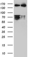 PADI4 ELISA with 5E7 Capture (TA600442) and 4H5 Detection (TA700441) Antibodies. Substrate used: Recombinant Human PADI4 (TP306501)