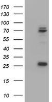 MUC1 ELISA with 1F3 Capture (TA600445) and 4A5 Detection (TA700446) Antibodies. Substrate used: Recombinant Human MUC1 (TP321390)