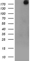 EGFR Luminex ELISA with 1C8 Capture (TA600470) and 11H7 Detection (TA700470) Antibodies. Substrate used: Recombinant Human EGFR (TP314877)