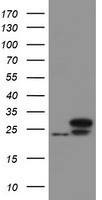 GOLM1 ELISA with 2D6 Capture (TA600479) and 2F3 Detection (TA700479) Antibodies. Substrate used: Recombinant Human GOLM1 (TP314745)