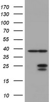 GOLM1 ELISA with 2F3 Capture (TA600480) and 2D6 Detection (TA700480) Antibodies. Substrate used: Recombinant Human GOLM1 (TP314745)