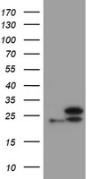 SERPINB3 ELISA with 1G9 Capture (TA600493) and 2H2 Detection (TA700493) Antibodies. Substrate used: Recombinant Human SERPINB3 (TP302683)