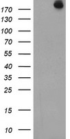 MYC ELISA with 1A6 Capture (TA600497) and 3F2 Detection (TA700497) Antibodies. Substrate used: Recombinant Human MYC (TP301611)