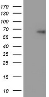 VBP1 Luminex with Anti-Tag 1B12 Capture (TA600050) and 2E6 Detection (TA700518) Antibodies. Substrate used: Recombinant Human VBP1 (TP308482)