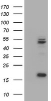 BUB1B ELISA with 3C7 Capture (TA600521) and 6E5 Detection (TA700531) Antibodies. Substrate used: Recombinant Human BUB1B (TP305844)