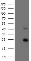 PCNA Luminex with 4G3 Capture (TA600538) and 1D11 Detection (TA700538) Antibodies. Substrate used: Recombinant Human PCNA (TP301741)