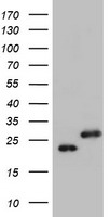 PCNA Luminex with 4G3 Capture (TA600538) and 4A2 Detection (TA700541) Antibodies. Substrate used: Recombinant Human PCNA (TP301741)