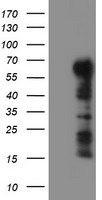 ESR1 Luminex with 8E9 Capture (TA600545) and 1B1 Detection (TA700546) Antibodies. Substrate used: Recombinant Human ESR1 (TP313277)