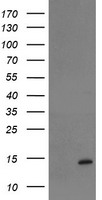 HEK293T cells were transfected with the pCMV6-ENTRY control (Left lane) or pCMV6-ENTRY SERPINB1 (RC202138, Right lane) cDNA for 48 hrs and lysed. Equivalent amounts of cell lysates (5 ug per lane) were separated by SDS-PAGE and immunoblotted with anti-SERPINB1. Positive lysates LY410744 (100 ug) and LC410744 (20 ug) can be purchased separately from OriGene.