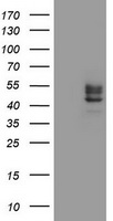 Immunohistochemistry of paraffin-embedded Human brain tissue using TA323535 (NPR1 Antibody) at dilution 1/30 (Original magnification: ×200)