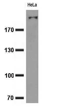 HEK293T cells were transfected with the pCMV6-ENTRY control (Left lane) or pCMV6-ENTRY SF3A1 (RC201098, Right lane) cDNA for 48 hrs and lysed. Equivalent amounts of cell lysates (5 ug per lane) were separated by SDS-PAGE and immunoblotted with anti-SF3A1. Positive lysates LY416998 (100 ug) and LC416998 (20 ug) can be purchased separately from OriGene.