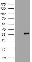 Gel: 8%SDS-PAGE<br>Lysate: 40 μg<br>Lane: Jurkat cells<br>Primary antibody: TA323636 (GNAS Antibody) at dilution 1/200<br>Secondary antibody: Goat anti rabbit IgG at 1/8000 dilution<br>Exposure time: 2 minutes