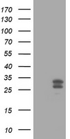 HEK293T cells were transfected with the pCMV6-ENTRY control (Left lane) or pCMV6-ENTRY SF3A1 (RC201098, Right lane) cDNA for 48 hrs and lysed. Equivalent amounts of cell lysates (5 ug per lane) were separated by SDS-PAGE and immunoblotted with anti-SF3A1. Positive lysates LY416998 (100 ug) and LC416998 (20 ug) can be purchased separately from OriGene.