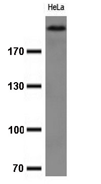 HEK293T cells were transfected with the pCMV6-ENTRY control (Left lane) or pCMV6-ENTRY CDH1 (RC220731, Right lane) cDNA for 48 hrs and lysed. Equivalent amounts of cell lysates (5 ug per lane) were separated by SDS-PAGE and immunoblotted with anti-CDH1 (1:500).