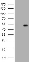 HEK293T cells were transfected with the pCMV6-ENTRY control (Left lane) or pCMV6-ENTRY CDH1 (RC220731, Right lane) cDNA for 48 hrs and lysed. Equivalent amounts of cell lysates (5 ug per lane) were separated by SDS-PAGE and immunoblotted with anti-CDH1 (1:500).