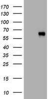 HEK293T cells were transfected with the pCMV6-ENTRY control (Left lane) or pCMV6-ENTRY SERBP1 (RC204527, Right lane) cDNA for 48 hrs and lysed. Equivalent amounts of cell lysates (5 ug per lane) were separated by SDS-PAGE and immunoblotted with anti-SERBP1. Positive lysates LY422719 (100 ug) and LC422719 (20 ug) can be purchased separately from OriGene.