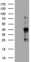 HEK293T cells were transfected with the pCMV6-ENTRY control (Left lane) or pCMV6-ENTRY SERBP1 (RC204527, Right lane) cDNA for 48 hrs and lysed. Equivalent amounts of cell lysates (5 ug per lane) were separated by SDS-PAGE and immunoblotted with anti-SERBP1. Positive lysates LY422719 (100 ug) and LC422719 (20 ug) can be purchased separately from OriGene.