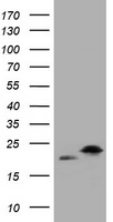 HEK293T cells were transfected with the pCMV6-ENTRY control (Left lane) or pCMV6-ENTRY KIT (RC209839, Right lane) cDNA for 48 hrs and lysed. Equivalent amounts of cell lysates (5 ug per lane) were separated by SDS-PAGE and immunoblotted with anti-KIT. Positive lysates LY424857 (100 ug) and LC424857 (20 ug) can be purchased separately from OriGene.
