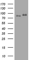 HEK293T cells were transfected with the pCMV6-ENTRY control (Left lane) or pCMV6-ENTRY NME1 (RC220517, Right lane) cDNA for 48 hrs and lysed. Equivalent amounts of cell lysates (5 ug per lane) were separated by SDS-PAGE and immunoblotted with anti-NME1. Positive lysates LY404982 (100 ug) and LC404982 (20 ug) can be purchased separately from OriGene.