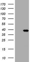 E.coli lysate (left lane) and E.coli lysate expressing human recombinant protein fragment corresponding to amino acids 230-560 of human PIK3C2A (NP_002636) were separated by SDS-PAGE and immunoblotted with anti-PIK3C2A.