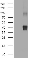 HEK293T cells were transfected with the pCMV6-ENTRY control (Left lane) or pCMV6-ENTRY POLI (RC207550, Right lane) cDNA for 48 hrs and lysed. Equivalent amounts of cell lysates (5 ug per lane) were separated by SDS-PAGE and immunoblotted with anti-POLI. Positive lysates LY416129 (100 ug) and LC416129 (20 ug) can be purchased separately from OriGene.