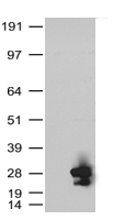 HEK293T cells were transfected with the pCMV6-ENTRY control (Left lane) or pCMV6-ENTRY POLI (RC207550, Right lane) cDNA for 48 hrs and lysed. Equivalent amounts of cell lysates (5 ug per lane) were separated by SDS-PAGE and immunoblotted with anti-POLI. Positive lysates LY416129 (100 ug) and LC416129 (20 ug) can be purchased separately from OriGene.