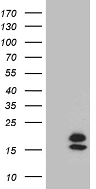 SORBS1 Antibody (Center) (Cat. #TA324366) western blot analysis in MDA-MB231 cell line lysates (35ug/lane).This demonstrates the SORBS1 antibody detected the SORBS1 protein (arrow).