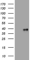 E.coli lysate (left lane) and E.coli lysate expressing human recombinant protein fragment corresponding to amino acids 230-560 of human PIK3C2A (NP_002636) were separated by SDS-PAGE and immunoblotted with anti-PIK3C2A.