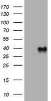 GAD2 Antibody (Center) (Cat. #TA324381) western blot analysis in Jurkat cell line lysates (35ug/lane).This demonstrates the GAD2 antibody detected the GAD2 protein (arrow).