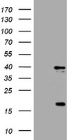 EAPII Antibody (C-term) (Cat. #TA324392) western blot analysis in A549 cell line lysates (35ug/lane).This demonstrates the EAPII antibody detected the EAPII protein (arrow).
