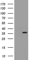 ATP6V1B1 Antibody (Center) (Cat. #TA324407) western blot analysis in WiDr, K562 cell line lysates (35ug/lane).This demonstrates the ATP6V1B1 antibody detected the ATP6V1B1 protein (arrow).