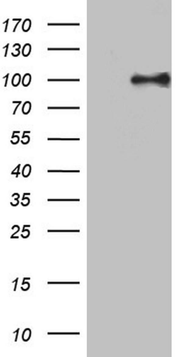 GALNS Antibody (Center) (Cat. #TA324418) western blot analysis in MCF-7 cell line lysates (35ug/lane).This demonstrates the GALNS antibody detected the GALNS protein (arrow).