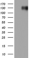 HDAC1 Antibody (N-term) (Cat. #TA324515) western blot analysis in MCF-7 cell line and human placenta and normal uterus, rat spleen lysates (35ug/lane).This demonstrates the HDAC1 antibody detected the HDAC1 protein (arrow).