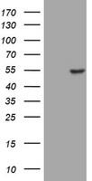 SUMO1 Antibody (N-term) (Cat. #TA324522) western blot analysis in ZR-75-1 cell line lysates (35ug/lane).This demonstrates the SUMO1 antibody detected the SUMO1 protein (arrow).