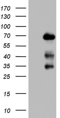 Western blot analysis of ALPL (arrow) using rabbit polyclonal ALPL Antibody (Center) (Cat.#TA324563). 293 cell lysates (2ug/lane) either nontransfected (Lane 1) or transiently transfected (Lane 2) with the ALPL gene.