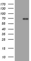 TADA3L Antibody (C-term) (Cat. #TA324564) western blot analysis in Hela cell line lysates (35ug/lane).This demonstrates the TADA3L antibody detected the TADA3L protein (arrow).
