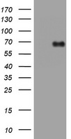 ACTA1/Î±-actin Antibody (C-term) (Cat.# TA324566) western blot analysis in A549, RD cell line and human placenta lysates (35ug/lane).This demonstrates the ACTA1/Î±-actin antibody detected the ACTA1/Î±-actin protein (arrow).