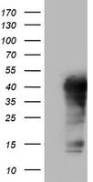 SPI1 Antibody (C-term) (Cat. #TA324571) western blot analysis in WiDr cell line lysates (35ug/lane).This demonstrates the SPI1 antibody detected the SPI1 protein (arrow).
