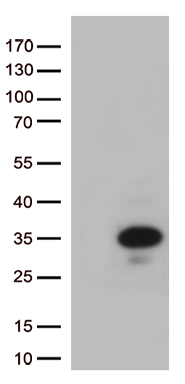 /assets/images/antibody/100/ta802218-1-w.jpg