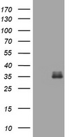 ESR2 Antibody (Center) (Cat. #TA324615) western blot analysis in MCF-7 cell line lysates (35ug/lane).This demonstrates the ESR2 antibody detected the ESR2 protein (arrow).