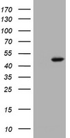 HEK293T cells were transfected with the pCMV6-ENTRY control (Left lane) or pCMV6-ENTRY TET1 (RC218608, Right lane) cDNA for 48 hrs and lysed. Equivalent amounts of cell lysates (5 ug per lane) were separated by SDS-PAGE and immunoblotted with anti-TET1.