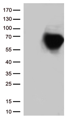 Western blot analysis of ESR1 isoform1 Antibody (C-term) Pab (Cat. #TA324673) pre-incubated without (lane 1) and with (lane 2) blocking peptide in K562 cell line lysate. ESR1 isoform1 Antibody (C-term) (arrow) was detected using the purified Pab.