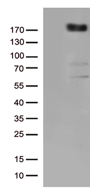 /assets/images/antibody/100/ta802443-1-w.jpg