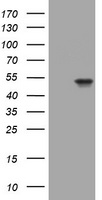 Western blot analysis of lysates from H-4-II-E, mouse NIH/3T3 cell line, mouse brain and rat brain tissues (from left to right), using STIP1 Antibody (C-term) (Cat. #TA324735). TA324735 was diluted at 1:1000 at each lane. A goat anti-rabbit (HRP) at 1:5000 dilution was used as the secondary antibody. Lysates at 35ug per lane.