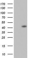STIP1 Antibody (Center) (Cat.# TA324736) western blot analysis in A431, A549 cell line lysates (35ug/lane).This demonstrates the STIP1 antibody detected the STIP1 protein (arrow).