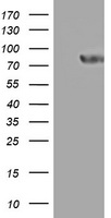 Western blot analysis of PRDX2 Antibody (C-term) (Cat. #TA324756) in MDA-MB231, 293 cell line and mouse brain tissue lysates (35ug/lane).PRDX2 (arrow) was detected using the purified Pab. (2ug/ml)