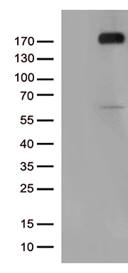 /assets/images/antibody/100/ta802572-1-w.jpg