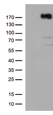/assets/images/antibody/100/ta802588-1-w.jpg