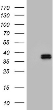The CDK7-T170 Pab (Cat. #TA324766) is used in Western blot to detect CDK7-T170 in Ramos tissue lysate.